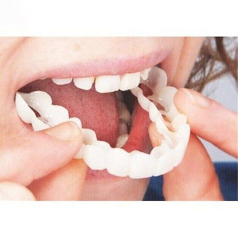 Teeth Whitening Veneers - Mükemmel Fit Yanlış Diş Kapağı Beyazlatma