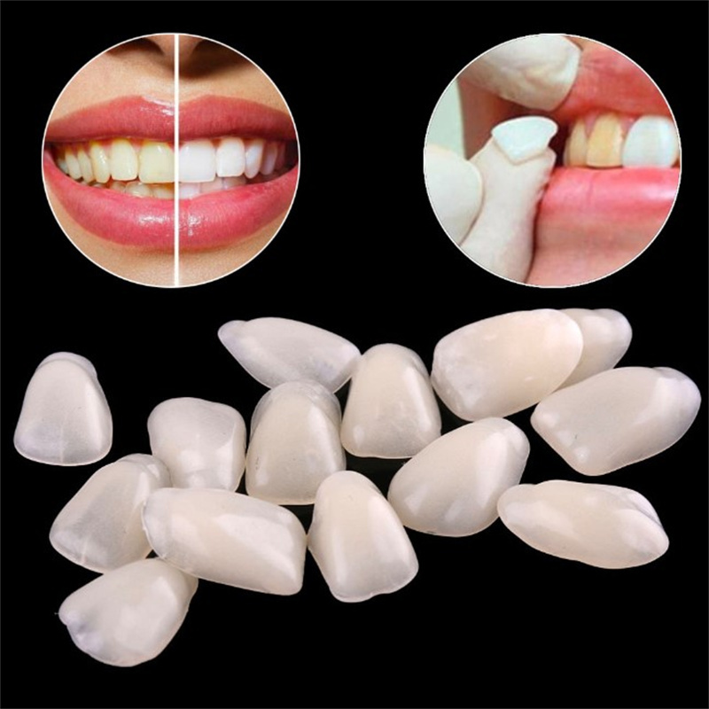 Teeth Whitening Veneers - Geçici Diş Kaplamaları - Diş Beyazlatma