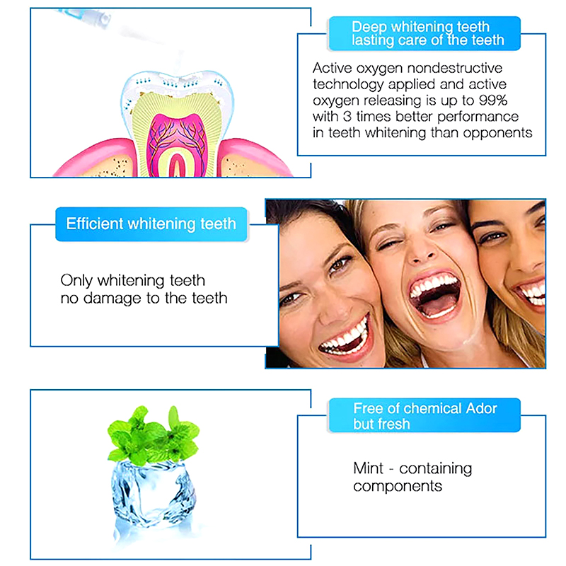 Diğer Diğer Diş Beyazlatma Kal - Teeth Whitening Bleaching Kit incelemesi ve fiyatı