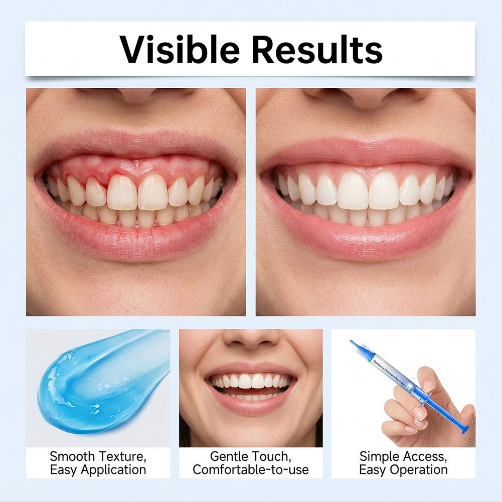 3 Adet Diş Eti Onarım Jeli, Hi - Teeth Whitening Products incelemesi ve fiyatı