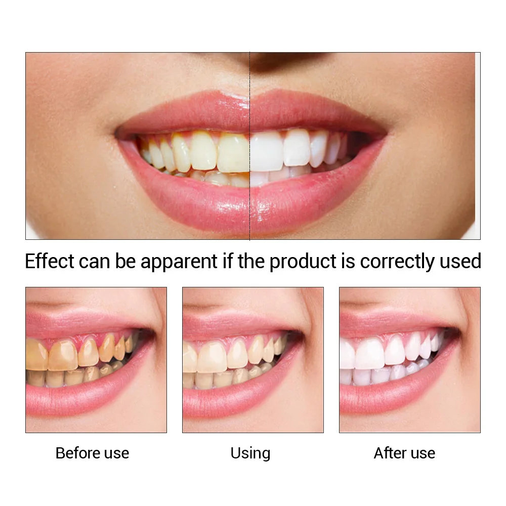 FTEENPLY diş beyazlatma özü to - Teeth Whitening Powder incelemesi ve fiyatı