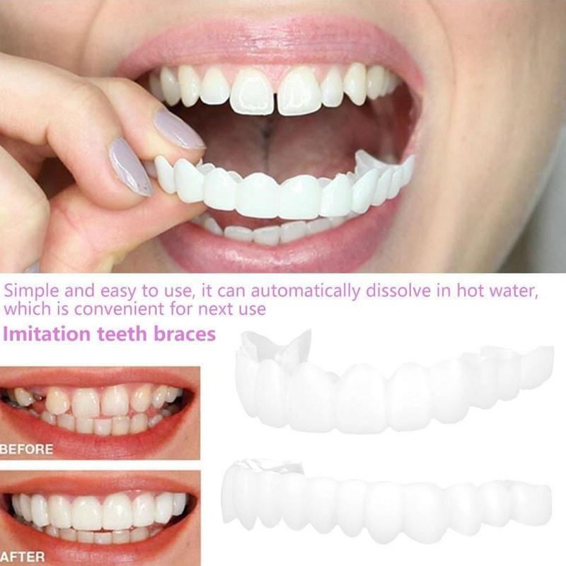 Snap On Diş Kaplamaları Anında - Teeth Whitening Veneers incelemesi ve fiyatı