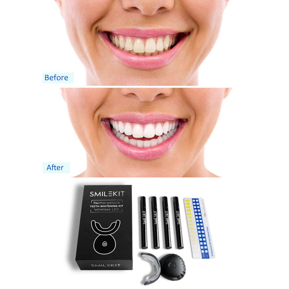 Yeni elektrikli diş beyazlatma - Teeth Whitening Bleaching Kit incelemesi ve fiyatı