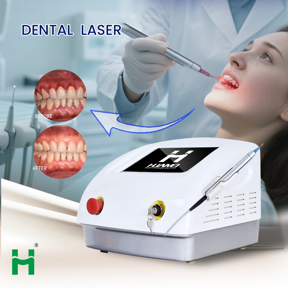 Taşınabilir LED Diş Beyazlatma - Teeth Whitening Bleaching Kit incelemesi ve fiyatı