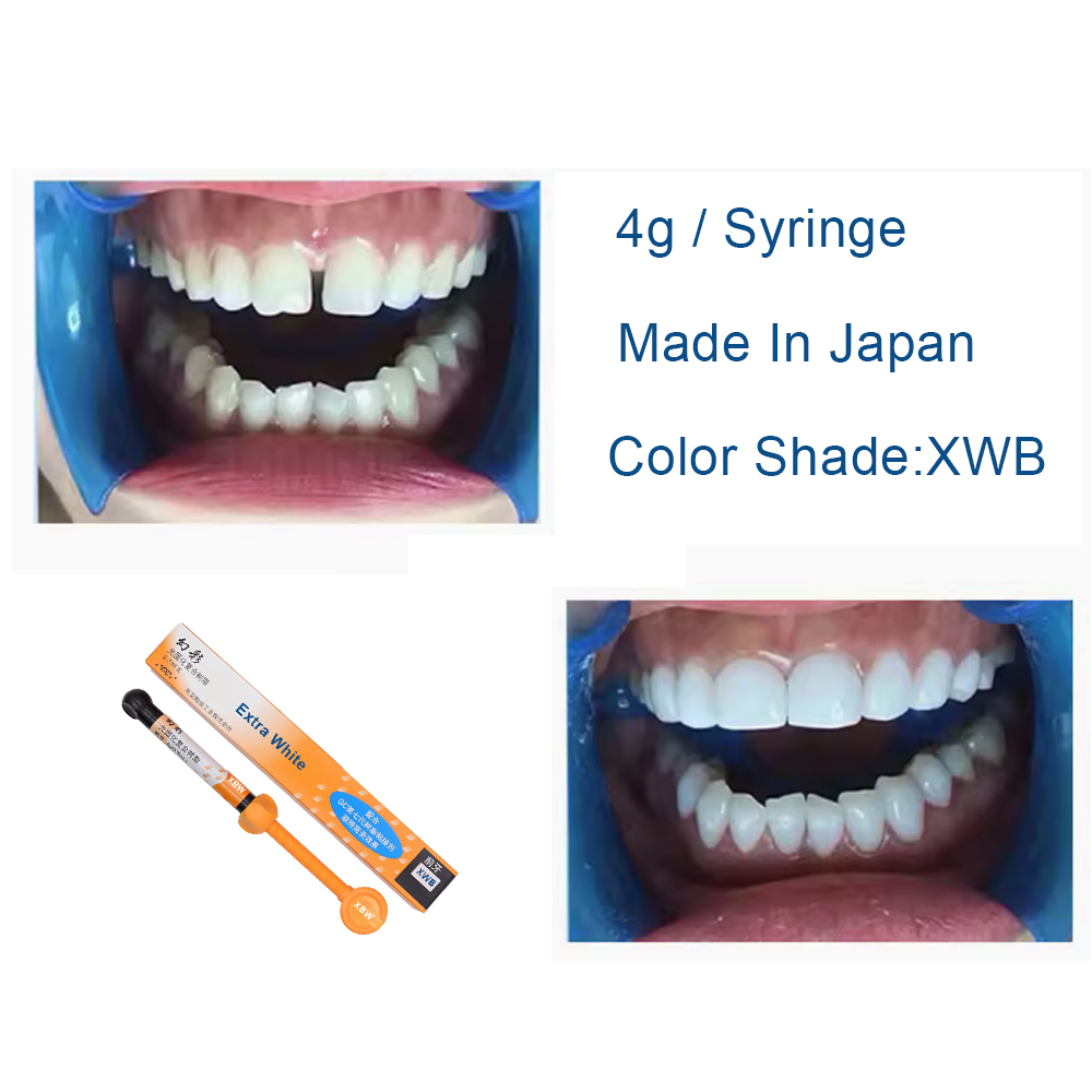 Diş Kompozit Reçinesi Ekstra B - Teeth Whitening Veneers incelemesi ve fiyatı