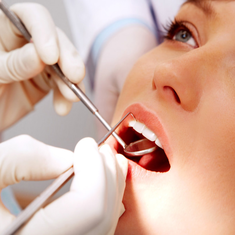 5 adet Paslanmaz Çelik Diş Ağı - Teeth Whitening Products incelemesi ve fiyatı