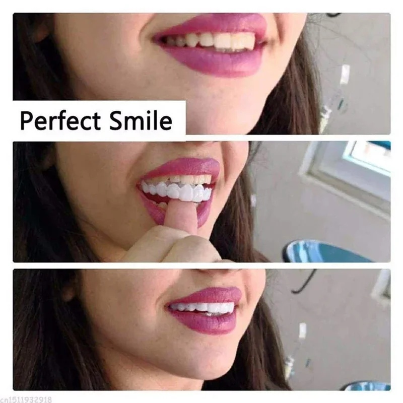 Çıkarılabilir Kaplama Diş Seti - Teeth Whitening Veneers incelemesi ve fiyatı