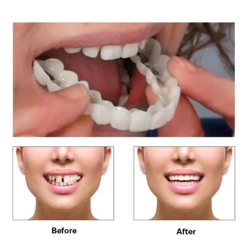 Çıkarılabilir Kaplama Diş Seti - Teeth Whitening Veneers incelemesi ve fiyatı